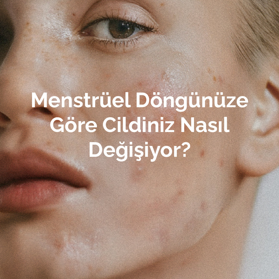 Menstrüel Döngünüze Göre Cildiniz Nasıl Değişiyor?